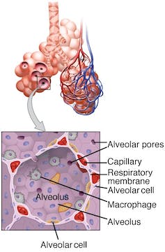 Illustration of a small section of lungs showing the alveoli and, within the alveoli, a close up of a microphage