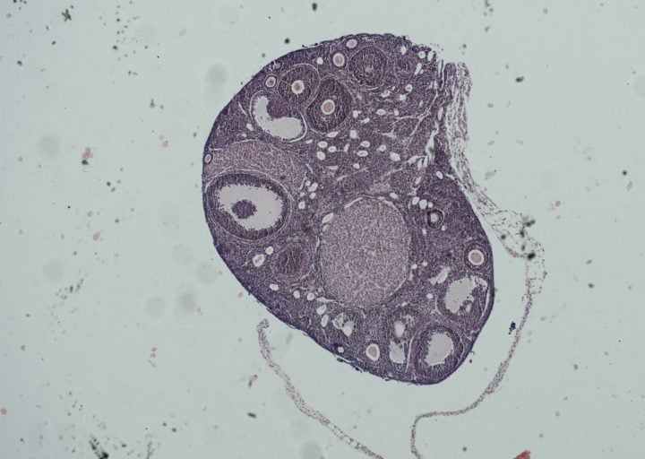 A section of ovarian tissue prepared for an investigation of ovarian function and bone health in space. 