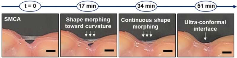 A brain-adhesive and shape-morphing sensor for transcranial ultrasound neurostimulation 