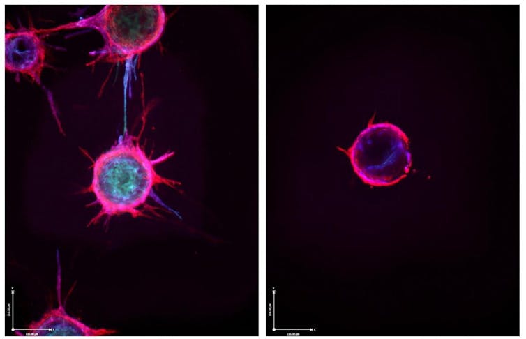 Microscopy image juxtaposing endothelial cells sprouting extensions to form new blood vessels and a cell bathed in microRNA unable to sprout