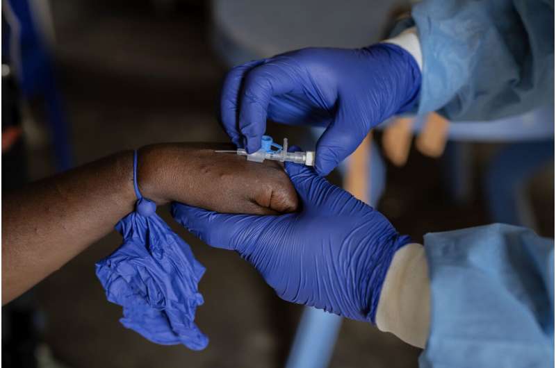 Mpox cases in Congo may be stabilizing. Experts say more vaccines are needed to stamp out virus