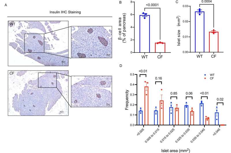 New insights into pancreatic disease and diabetes