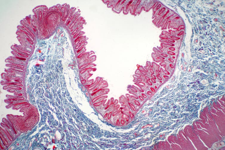 Microscopy image of human large intestine tissue, which appears as two curved arms layered with fringe