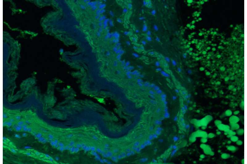 Immunofluorescent staining for macrophages (CD68, green) and nuclei (DAPI, blue) on the hydrogel-tissue interface seven days after sealing lung incisions in rats. Credit: Dr. Mahsa Ghovvati Better than stitches, researchers develop biocompatible patch for soft organ injuries