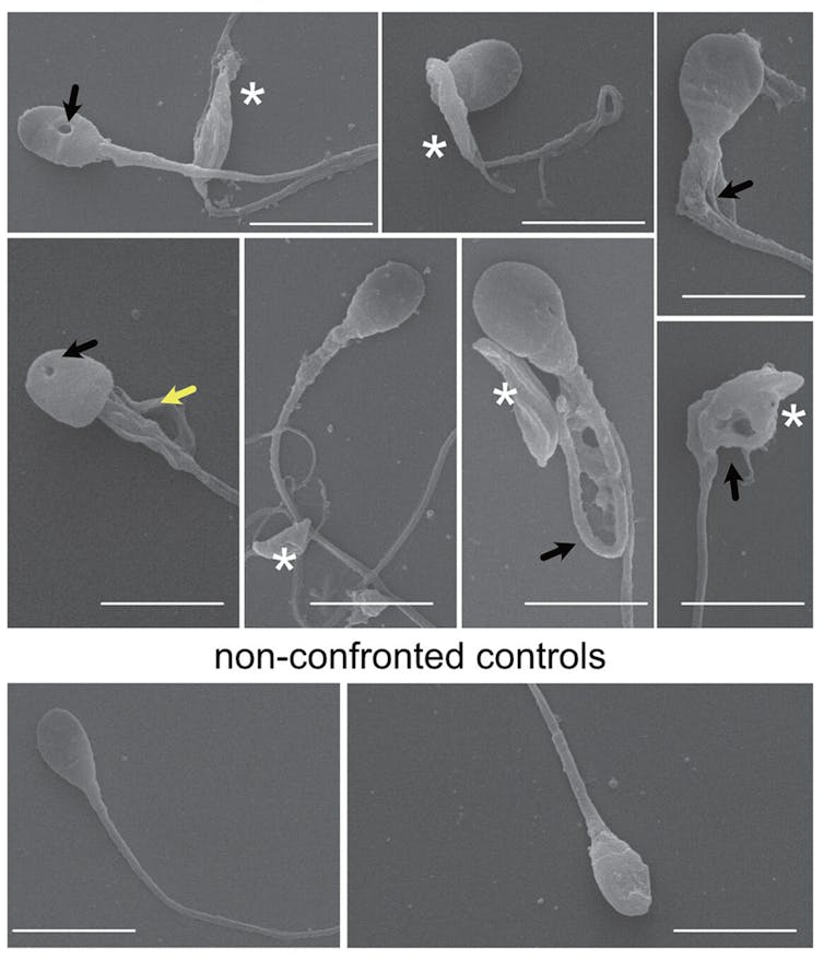 Series of microscopy images of slightly deformed sperm with holes in their heads