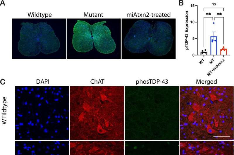 Effects of miAtxn2 on TDP-43 levels and pathology. Credit: Nature Communications (2025). DOI: 10.1038/s41467-025-60497-8 Gene therapy may slow loss of motor function in ALS, research finds