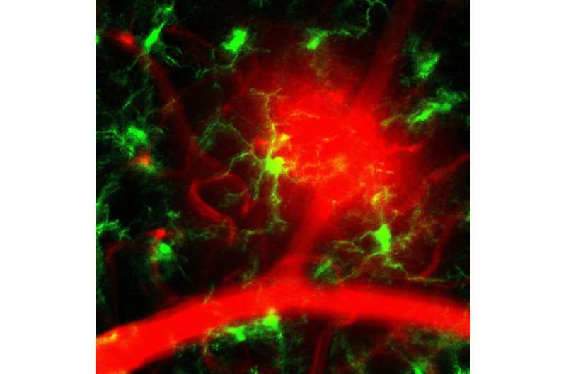 The mouse eye as a window to spotting systemic disease