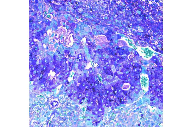 'Good' gut bacteria boosts placenta for healthier pregnancy