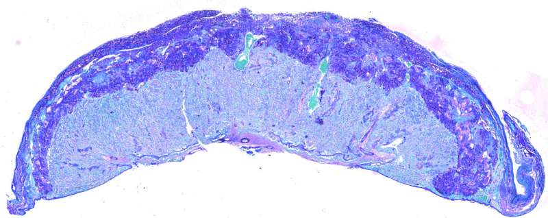 'Good' gut bacteria boosts placenta for healthier pregnancy