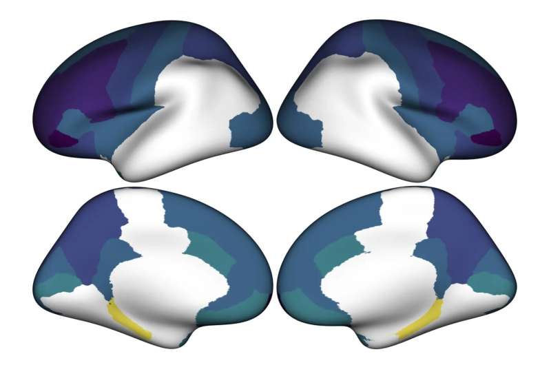 Living in an unequal society impacts the structure of children's brains, study finds