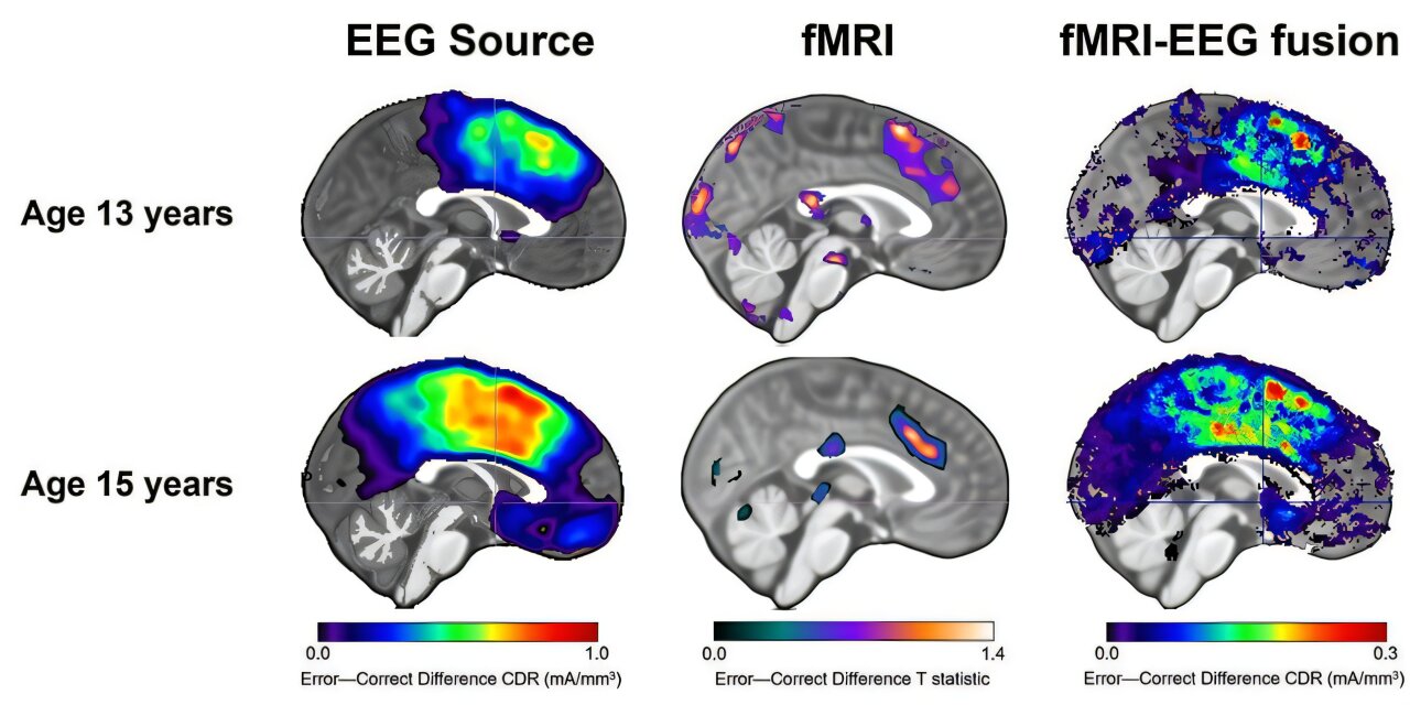 Combining two brain scans uncovers hidden clues to future teen anxiety ...
