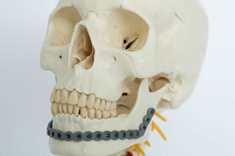 Innovative surfaces to rapidly load bone implants with antibiotics