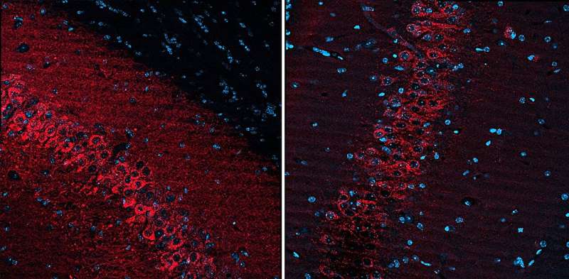 Nonsurgical treatment shows promise for targeted seizure control