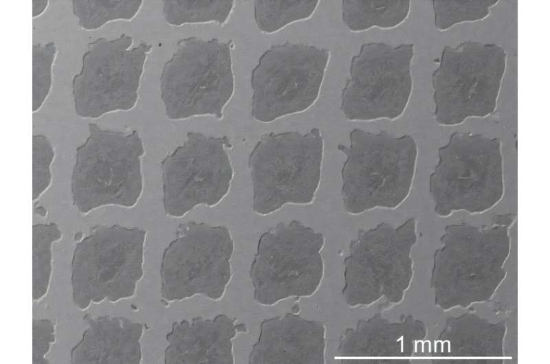 Microscopic image of the new metal matrix composite, which mimics the structure of concrete on a tiny scale. Credit: Chenwei Shao U of T researchers develop ultra-strong, lightweight metal composite that can withstand extreme heat