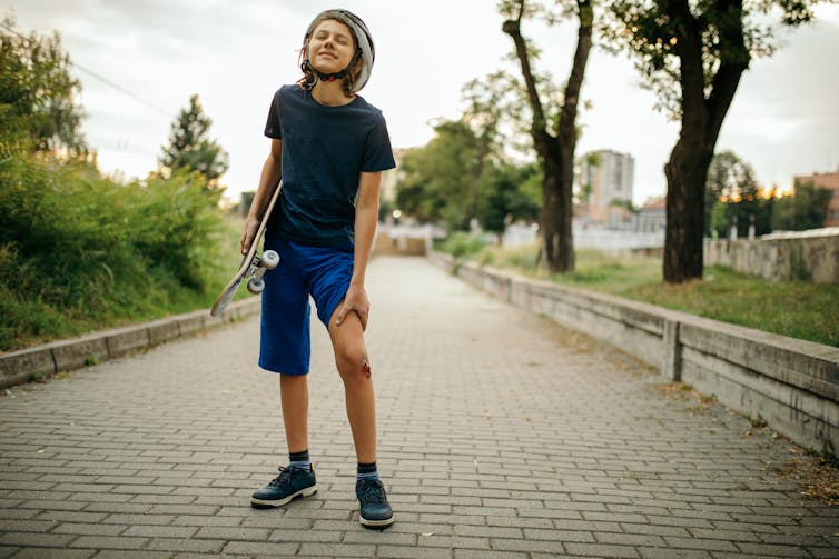 boy wearing helmet holding a skateboard and showing a skinned knee